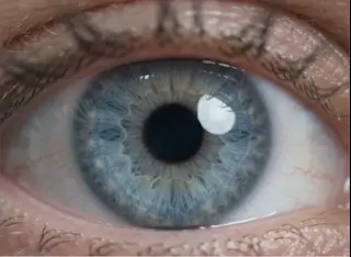 Dioptria.jpg